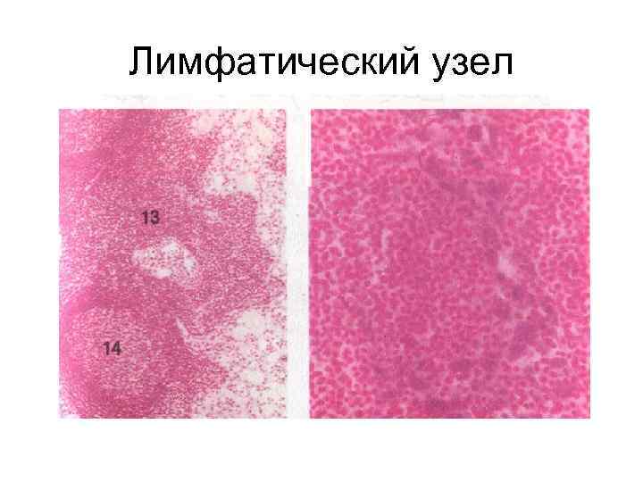 Лимфатический узел 