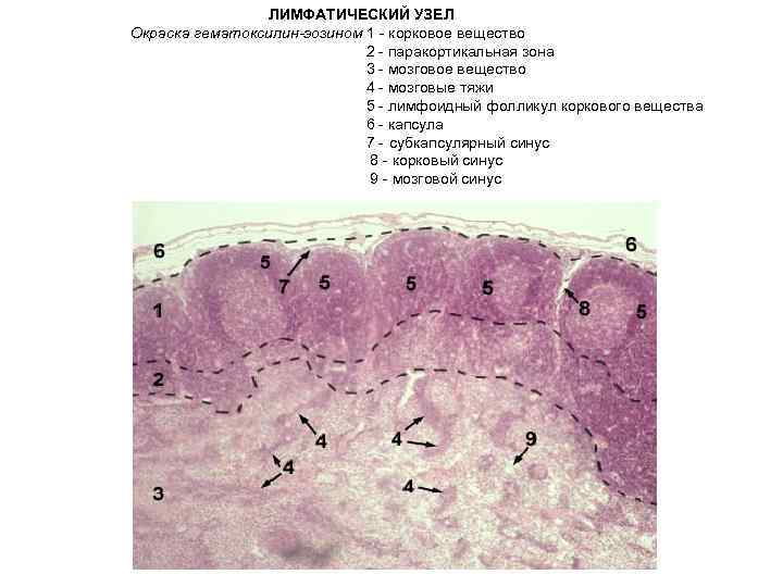 ЛИМФАТИЧЕСКИЙ УЗЕЛ Окраска гематоксилин-эозином 1 - корковое вещество 2 - паракортикальная зона 3 -