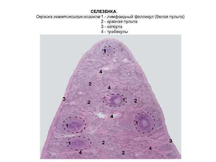 СЕЛЕЗЕНКА Окраска гематоксилин-эозином 1 - лимфоидный фолликул (белая пульпа) 2 - красная пульпа 3