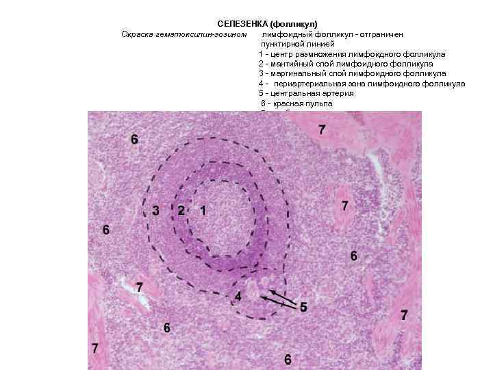 СЕЛЕЗЕНКА (фолликул) Окраска гематоксилин-эозином лимфоидный фолликул - отграничен пунктирной линией 1 - центр размножения