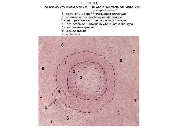  СЕЛЕЗЕНКА Окраска гематоксилин-эозином лимфоидный фолликул - отграничен пунктирной линией 1 - маргинальный слой