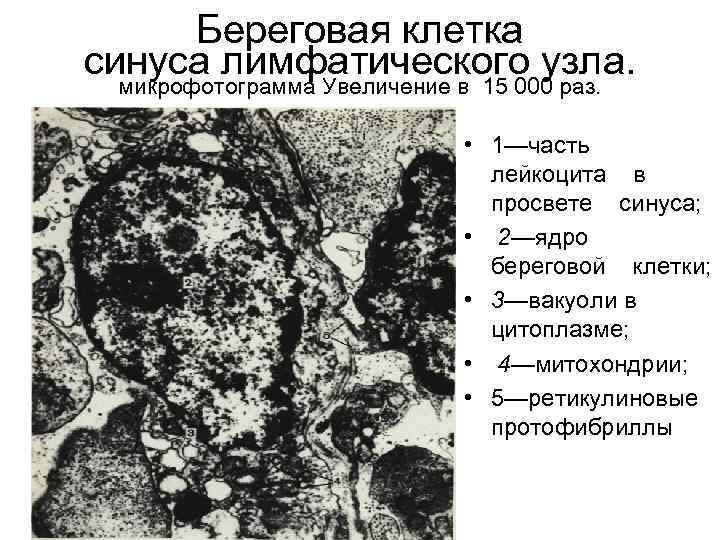 Береговая клетка синуса лимфатического узла. микрофотограмма Увеличение в 15 000 раз. • 1—часть лейкоцита