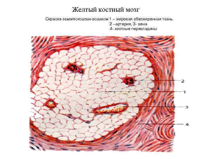  Желтый костный мозг Окраска гематоксилин-эозином 1 – жировая обезжиренная ткань 2 –артерия, 3