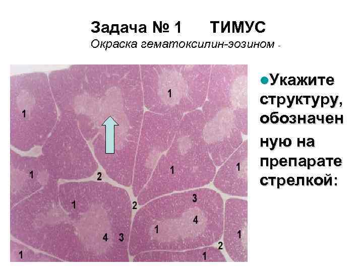 Задача № 1 ТИМУС Окраска гематоксилин-эозином - l. Укажите структуру, обозначен ную на препарате