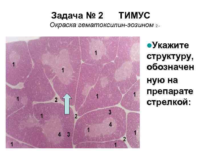 Задача № 2 ТИМУС Окраска гематоксилин-эозином 2 - l. Укажите структуру, обозначен ную на