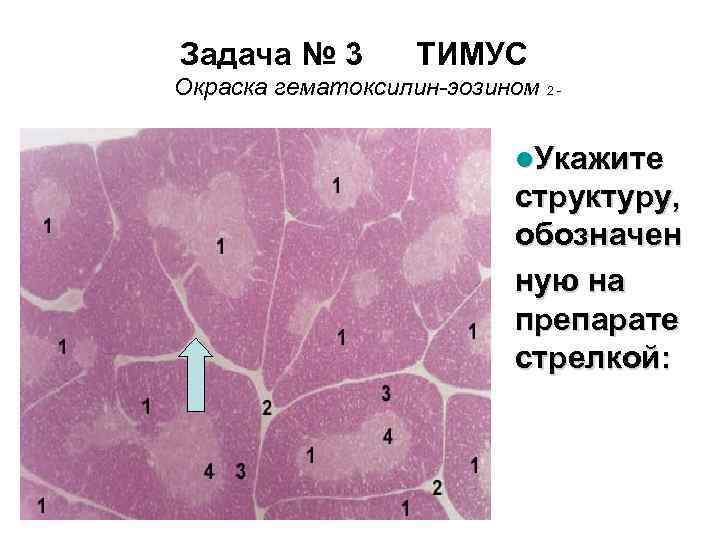 Задача № 3 ТИМУС Окраска гематоксилин-эозином 2 - l. Укажите структуру, обозначен ную на