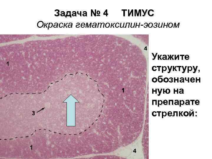 Задача № 4 ТИМУС Окраска гематоксилин-эозином Укажите структуру, обозначен ную на препарате стрелкой: 