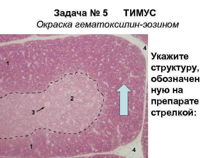 Задача № 5 ТИМУС Окраска гематоксилин-эозином Укажите структуру, обозначен ную на препарате стрелкой: 