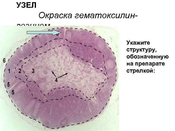 УЗЕЛ Окраска гематоксилинэозином Укажите структуру, обозначенную на препарате стрелкой: 