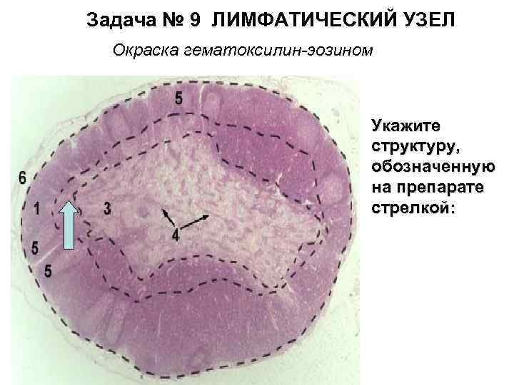  Задача № 9 ЛИМФАТИЧЕСКИЙ УЗЕЛ Окраска гематоксилин-эозином Укажите структуру, обозначенную на препарате стрелкой: