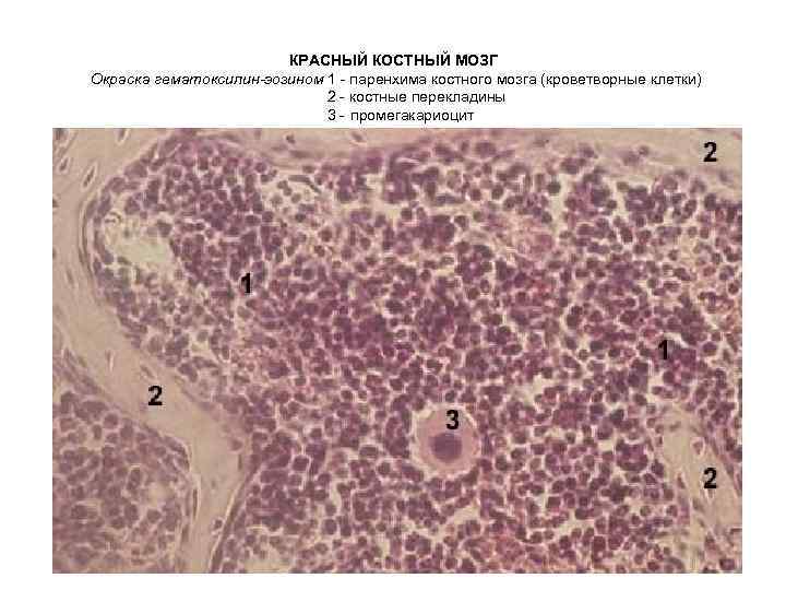 КРАСНЫЙ КОСТНЫЙ МОЗГ Окраска гематоксилин-эозином 1 - паренхима костного мозга (кроветворные клетки) 2 -