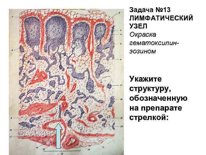 Задача № 13 ЛИМФАТИЧЕСКИЙ УЗЕЛ Окраска гематоксилинэозином Укажите структуру, обозначенную на препарате стрелкой: 