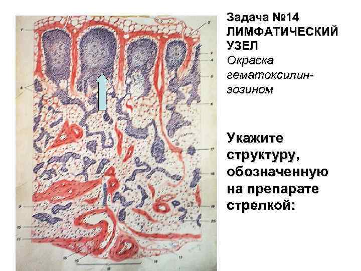 Задача № 14 ЛИМФАТИЧЕСКИЙ УЗЕЛ Окраска гематоксилинэозином Укажите структуру, обозначенную на препарате стрелкой: 