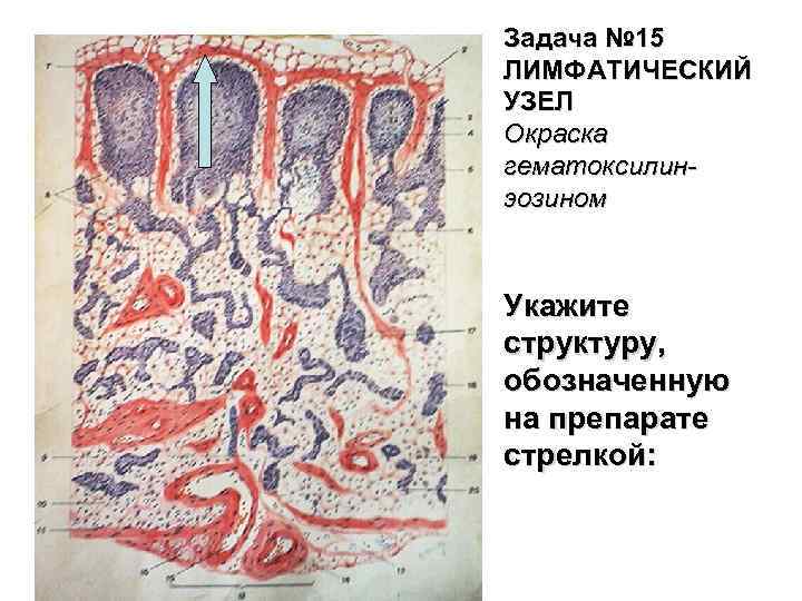 Задача № 15 ЛИМФАТИЧЕСКИЙ УЗЕЛ Окраска гематоксилинэозином Укажите структуру, обозначенную на препарате стрелкой: 