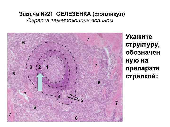 Задача № 21 СЕЛЕЗЕНКА (фолликул) Окраска гематоксилин-эозином Укажите структуру, обозначен ную на препарате стрелкой: