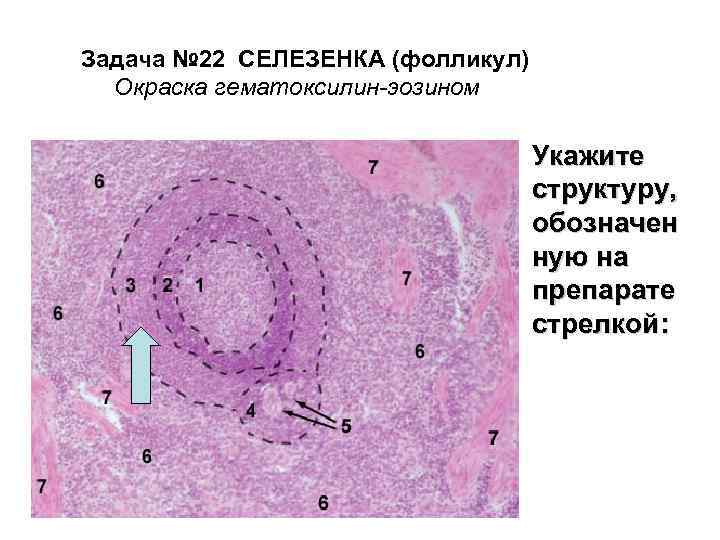 Задача № 22 СЕЛЕЗЕНКА (фолликул) Окраска гематоксилин-эозином Укажите структуру, обозначен ную на препарате стрелкой: