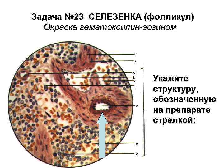 Задача № 23 СЕЛЕЗЕНКА (фолликул) Окраска гематоксилин-эозином Укажите структуру, обозначенную на препарате стрелкой: 