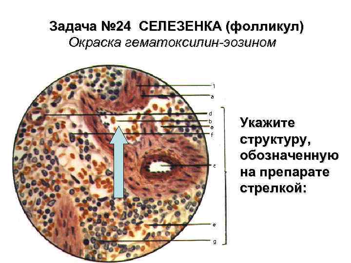 Задача № 24 СЕЛЕЗЕНКА (фолликул) Окраска гематоксилин-эозином Укажите структуру, обозначенную на препарате стрелкой: 