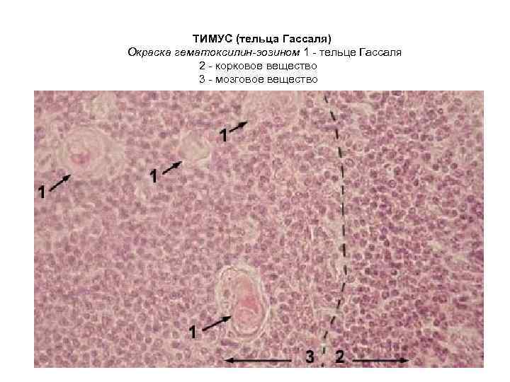 ТИМУС (тельца Гассаля) Окраска гематоксилин-эозином 1 - тельце Гассаля 2 - корковое вещество 3
