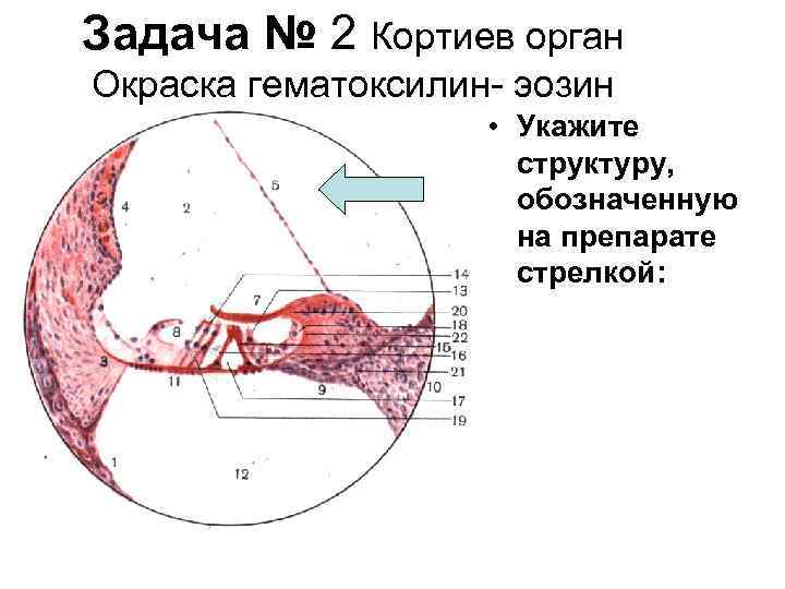 Задача № 2 Кортиев орган Окраска гематоксилин эозин • Укажите структуру, обозначенную на препарате