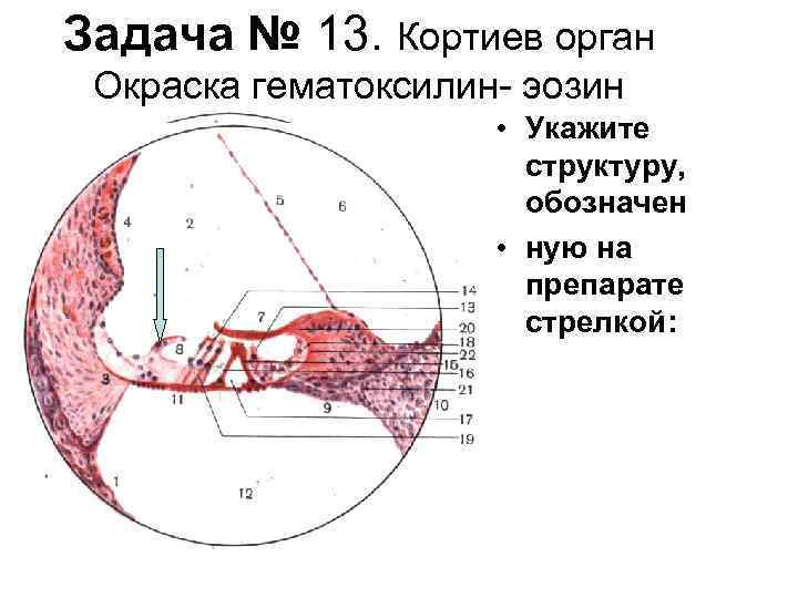 Задача № 13. Кортиев орган Окраска гематоксилин эозин • Укажите структуру, обозначен • ную