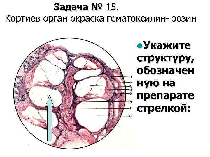 Задача № 15. Кортиев орган окраска гематоксилин- эозин l. Укажите структуру, обозначен ную на