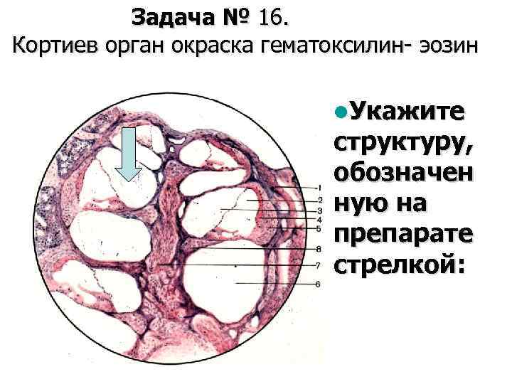Задача № 16. Кортиев орган окраска гематоксилин- эозин l. Укажите структуру, обозначен ную на