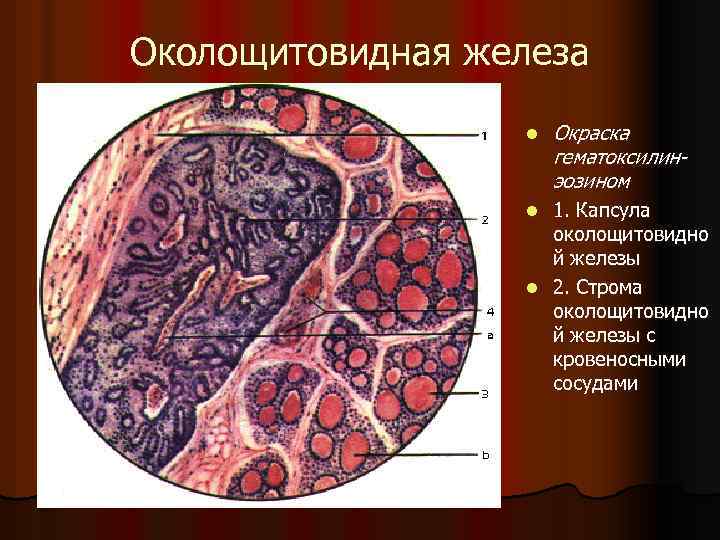 Околощитовидная железа l Окраска гематоксилинэозином 1. Капсула околощитовидно й железы l 2. Строма околощитовидно