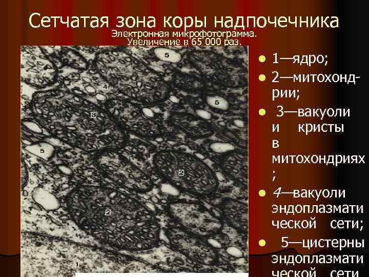 Сетчатая зона надпочечника вырабатывает