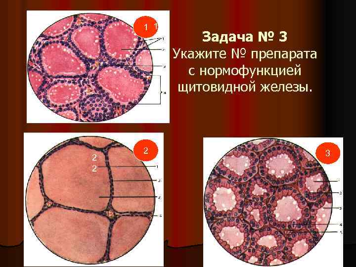 1 1 1 2 2 2 Задача № 3 Укажите № препарата с нормофункцией