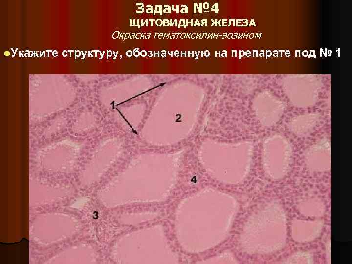 Задача № 4 ЩИТОВИДНАЯ ЖЕЛЕЗА Окраска гематоксилин-эозином l. Укажите структуру, обозначенную на препарате под