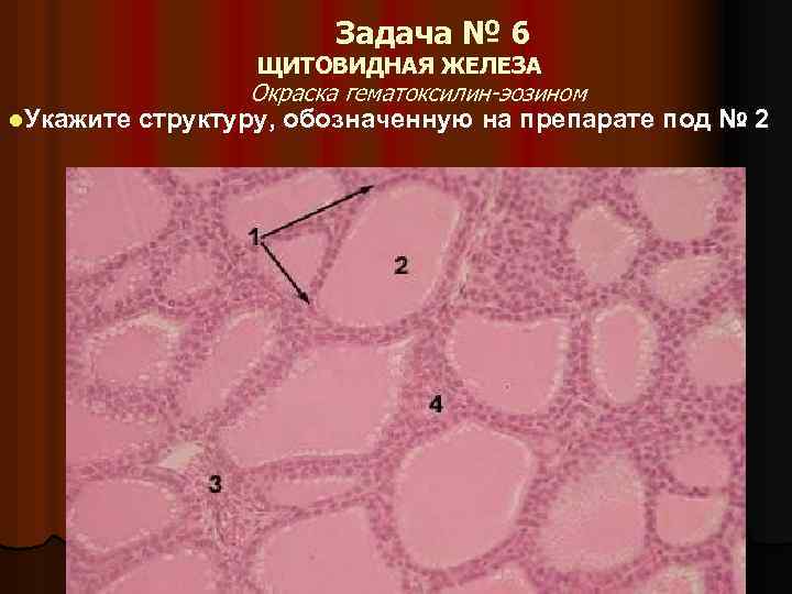 Задача № 6 ЩИТОВИДНАЯ ЖЕЛЕЗА Окраска гематоксилин-эозином l. Укажите структуру, обозначенную на препарате под