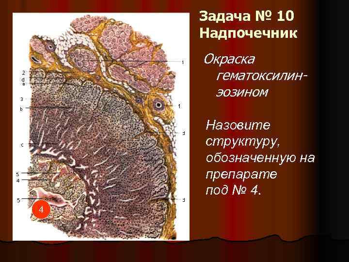 Задача № 10 Надпочечник Окраска гематоксилинэозином Назовите структуру, обозначенную на препарате под № 4.