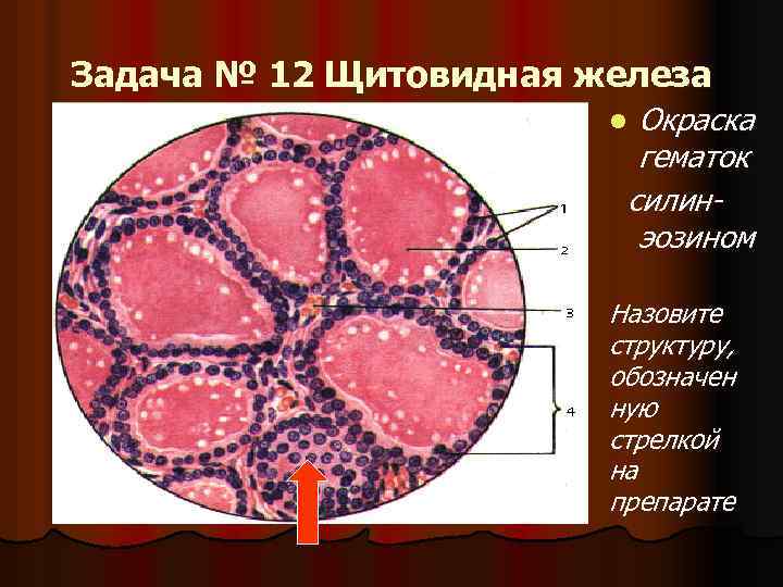 Задача № 12 Щитовидная железа Окраска гематок силинэозином l Назовите структуру, обозначен ную стрелкой