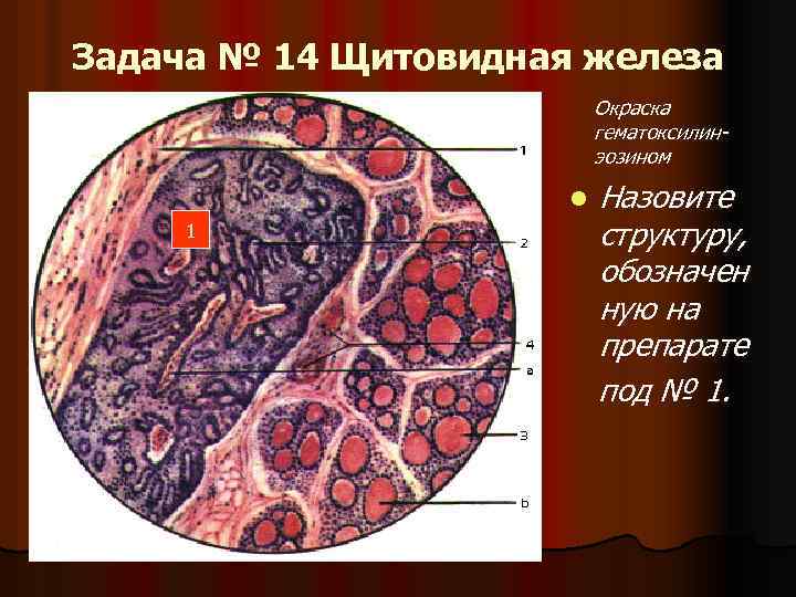 Схему образования желчных пигментов