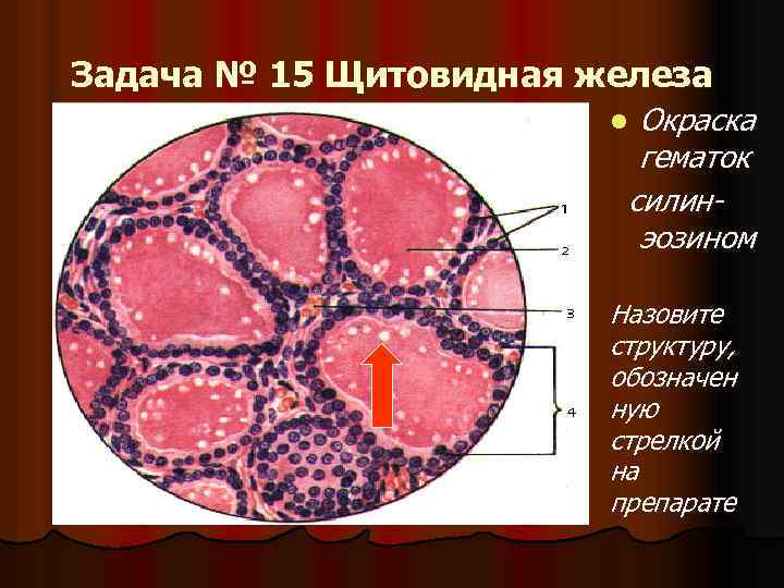 Задача № 15 Щитовидная железа Окраска гематок силинэозином l Назовите структуру, обозначен ную стрелкой