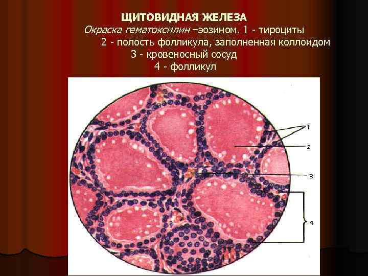 Коллоид фолликулов щитовидной железы