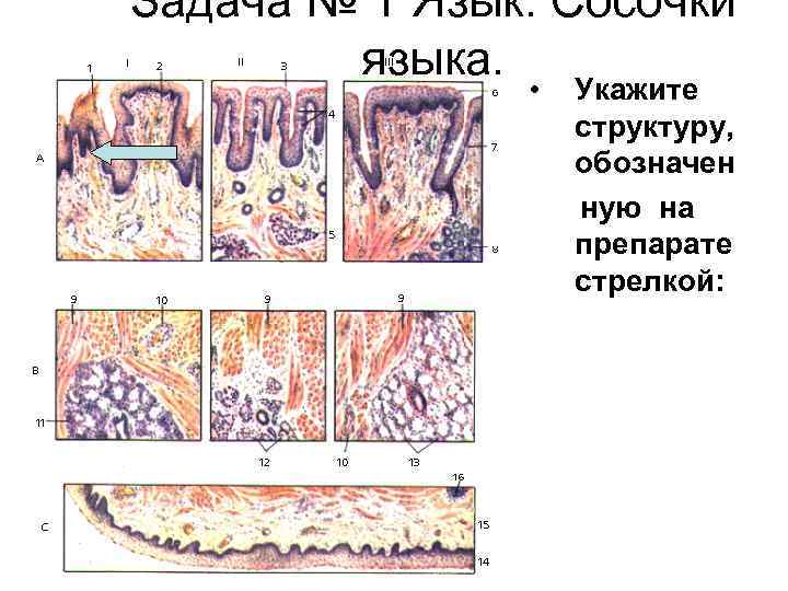 Задача № 1 Язык. Сосочки языка. • Укажите структуру, обозначен ную на препарате стрелкой: