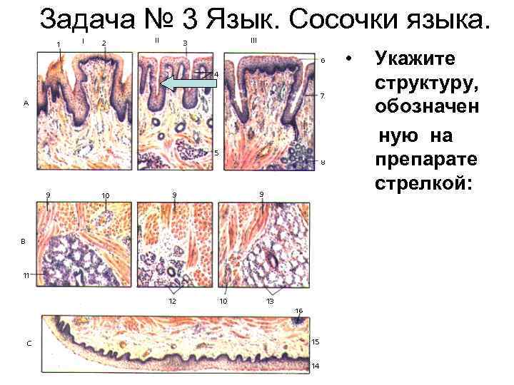 Задача № 3 Язык. Сосочки языка. • Укажите структуру, обозначен ную на препарате стрелкой:
