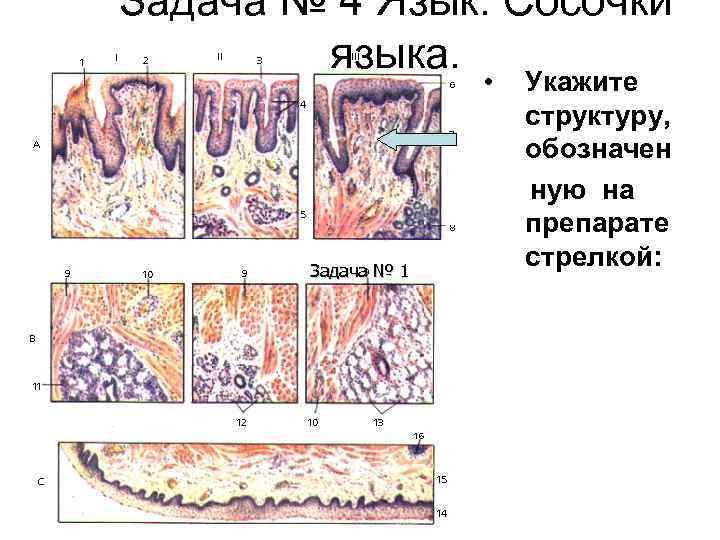 Задача № 4 Язык. Сосочки языка. • Задача № 1 Укажите структуру, обозначен ную