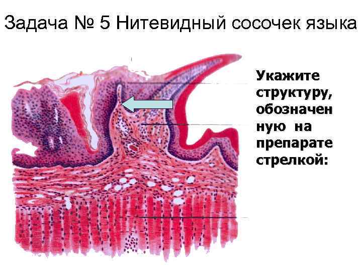 Задача № 5 Нитевидный сосочек языка Укажите структуру, обозначен ную на препарате стрелкой: 