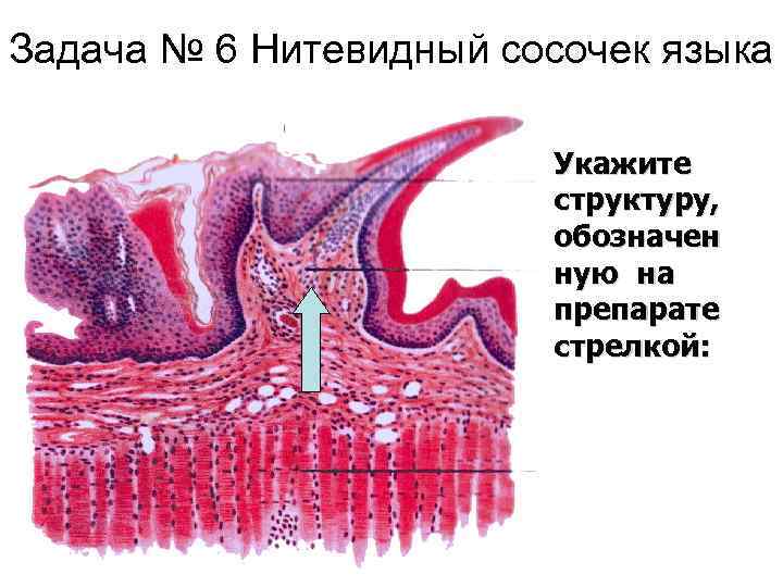 Задача № 6 Нитевидный сосочек языка Укажите структуру, обозначен ную на препарате стрелкой: 