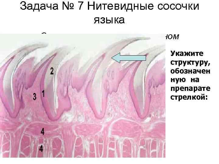 Задача № 7 Нитевидные сосочки языка Окраска гематоксилин-эозином Укажите структуру, обозначен ную на препарате