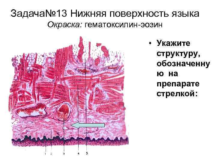 Задача№ 13 Нижняя поверхность языка Окраска: гематоксилин-эозин • Укажите структуру, обозначенну ю на препарате