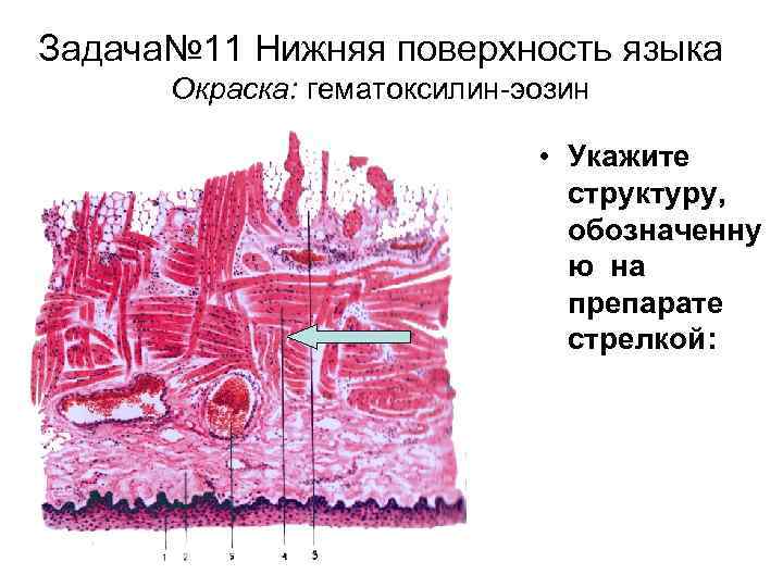 Задача№ 11 Нижняя поверхность языка Окраска: гематоксилин-эозин • Укажите структуру, обозначенну ю на препарате