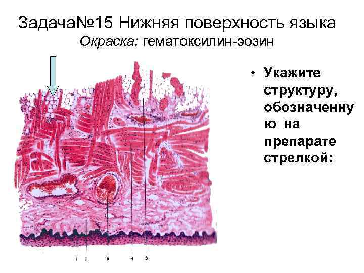 Задача№ 15 Нижняя поверхность языка Окраска: гематоксилин-эозин • Укажите структуру, обозначенну ю на препарате