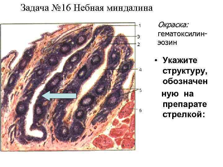 Небная миндалина гистология рисунок