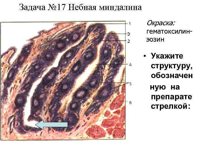 Задача № 17 Небная миндалина Окраска: гематоксилинэозин • Укажите структуру, обозначен ную на препарате