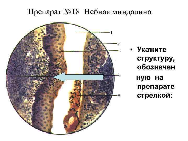 Препарат № 18 Небная миндалина • Укажите структуру, обозначен ную на препарате стрелкой: 