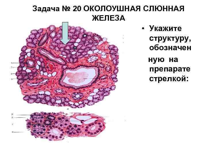 Околоушная слюнная железа гистология рисунок